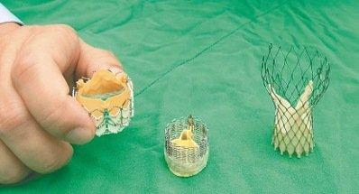 医用领域、、塑料